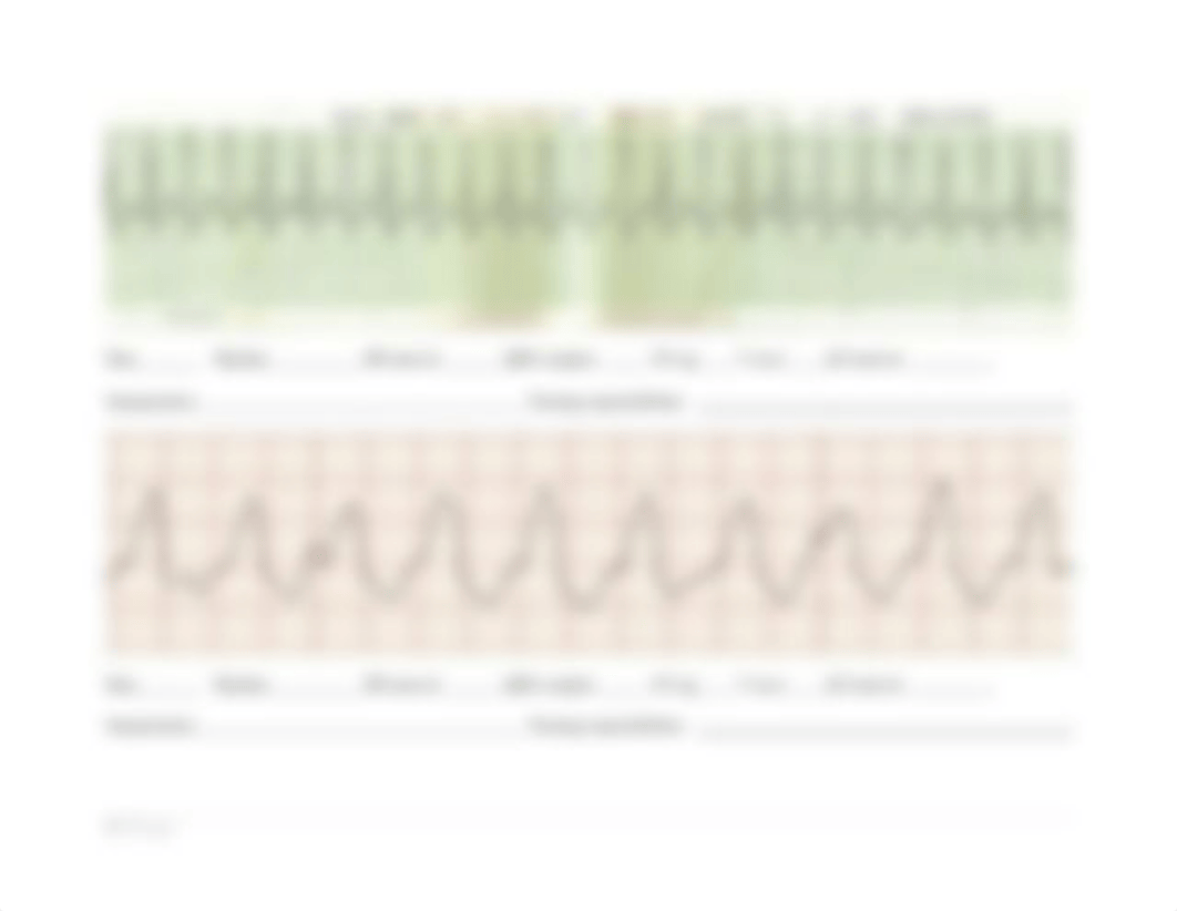 NUR 202 ECG Strip Student Practice.docx_dktszx2z4zv_page5