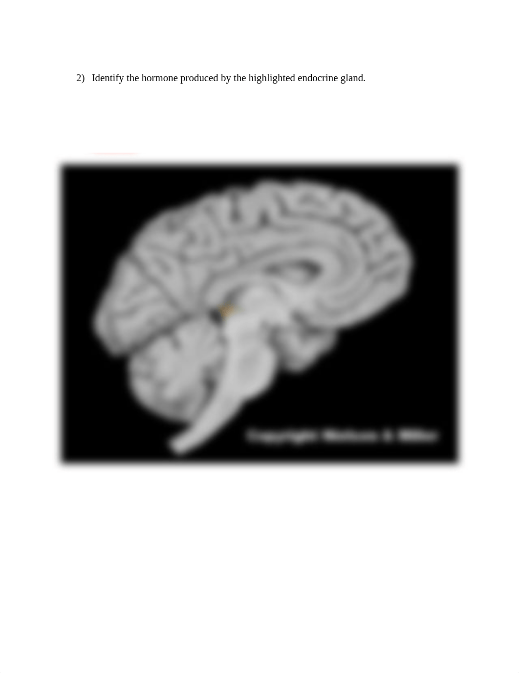 Real Anatomy Endocrine Anatomy & Production Sites.docx_dkuufwe67vy_page2