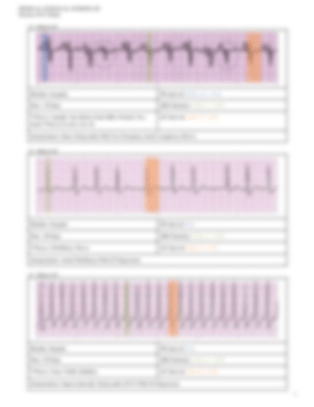 MS III - Practice ECG Strips (Key).pdf_dl0oq2yv9w1_page5