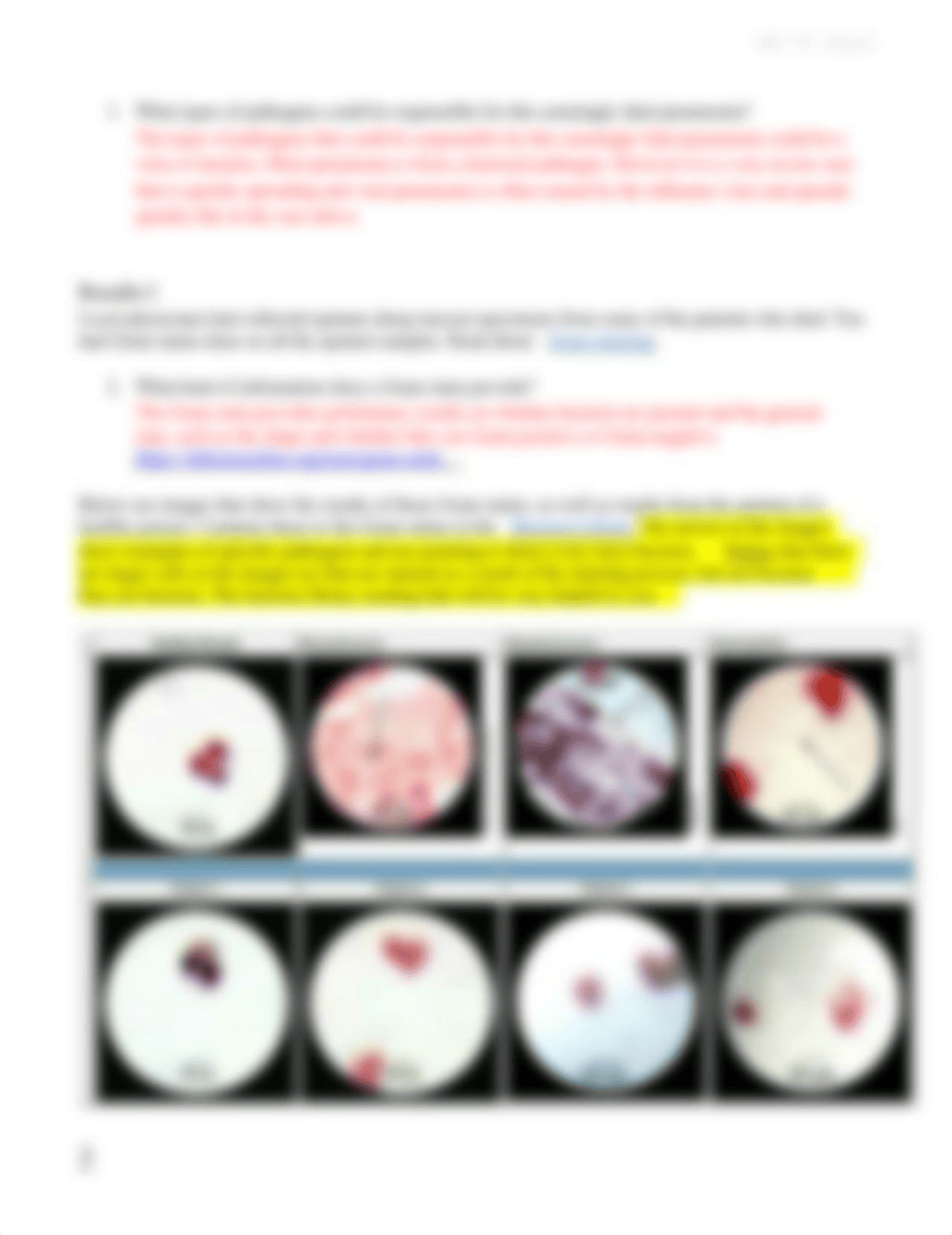 3 Microscopy- The Fatal Flu.docx_dl1jik7oma6_page2