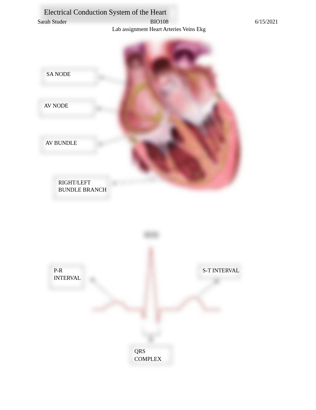 Lab Heart blood vessels EKG.docx_dl6h16p1ppb_page4