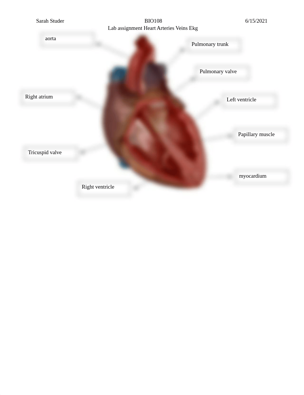 Lab Heart blood vessels EKG.docx_dl6h16p1ppb_page2