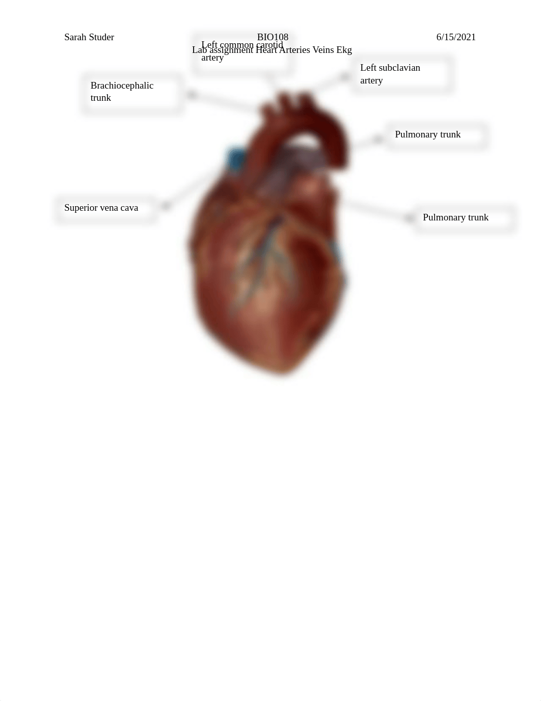 Lab Heart blood vessels EKG.docx_dl6h16p1ppb_page3