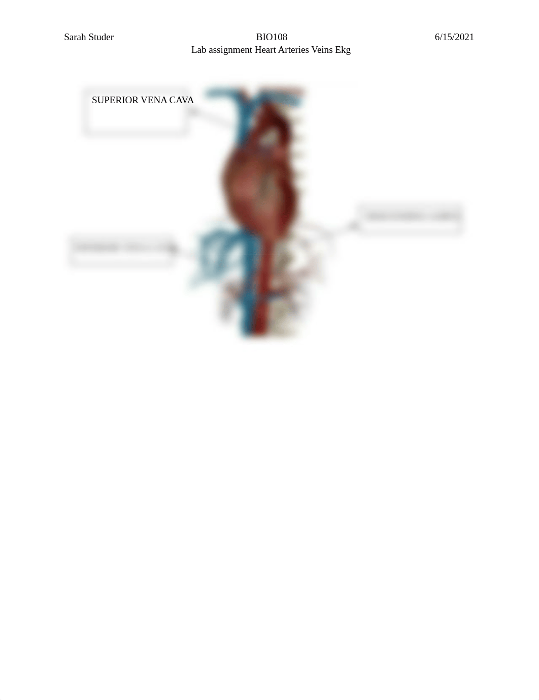 Lab Heart blood vessels EKG.docx_dl6h16p1ppb_page5