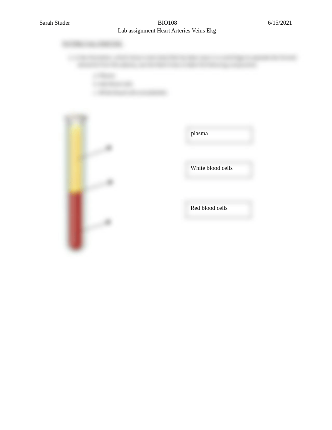 Lab Heart blood vessels EKG.docx_dl6h16p1ppb_page1