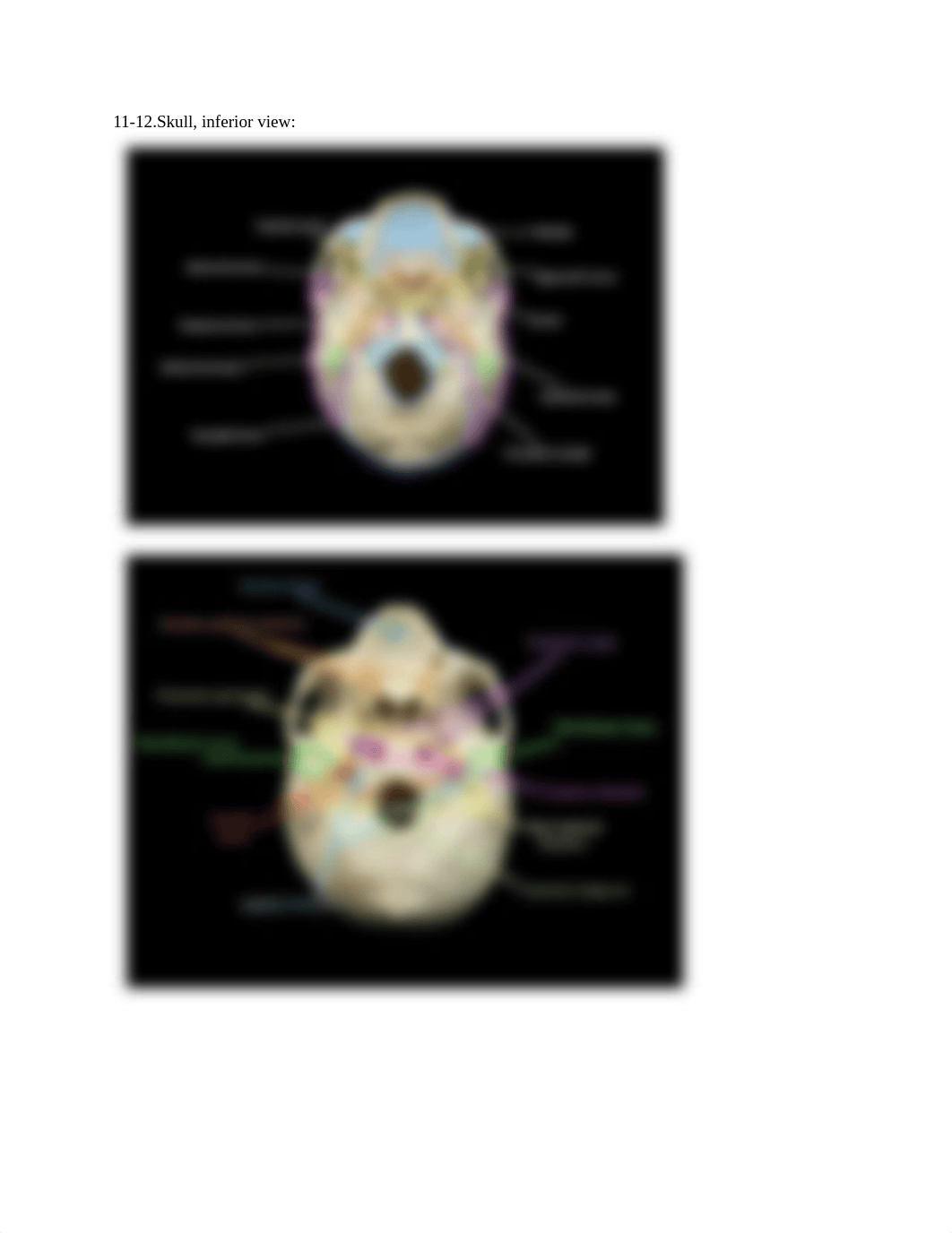 Skull_ Axial Skeleton.docx_dl9k33fojh8_page5