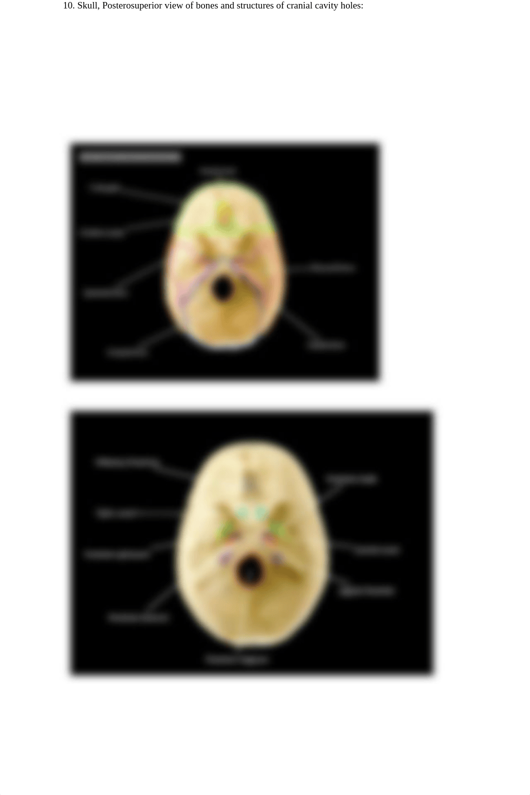 Skull_ Axial Skeleton.docx_dl9k33fojh8_page4