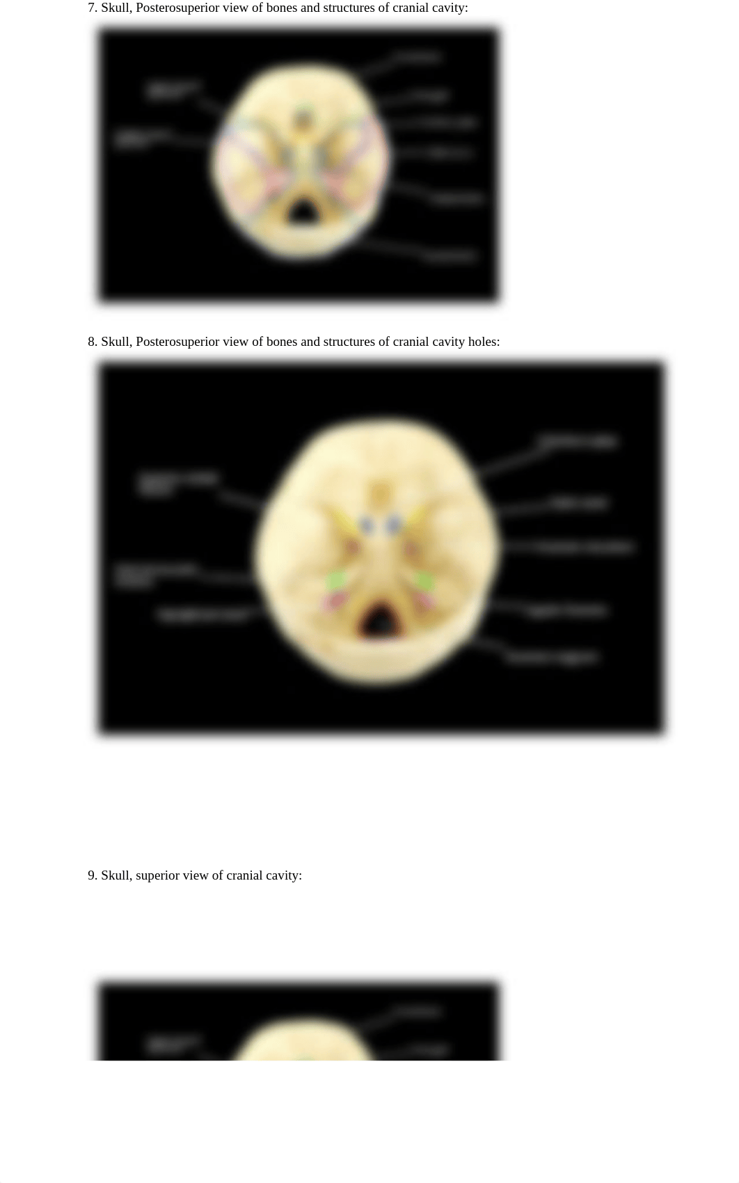 Skull_ Axial Skeleton.docx_dl9k33fojh8_page3