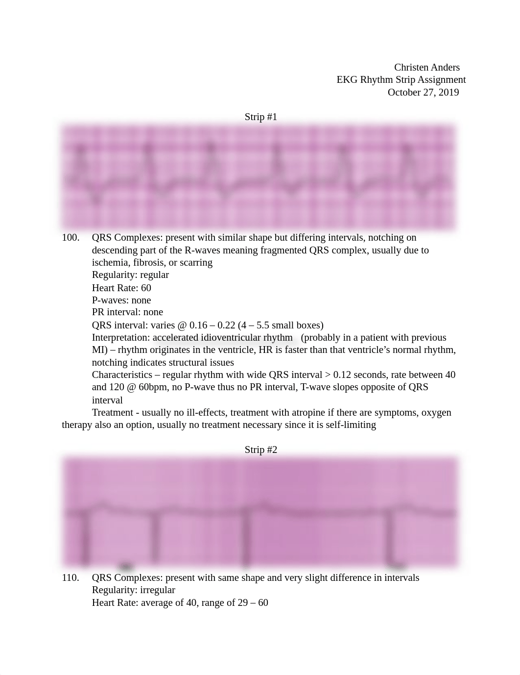 EKG Rhythm Stip Assignment.docx_dlm7099vjtk_page1