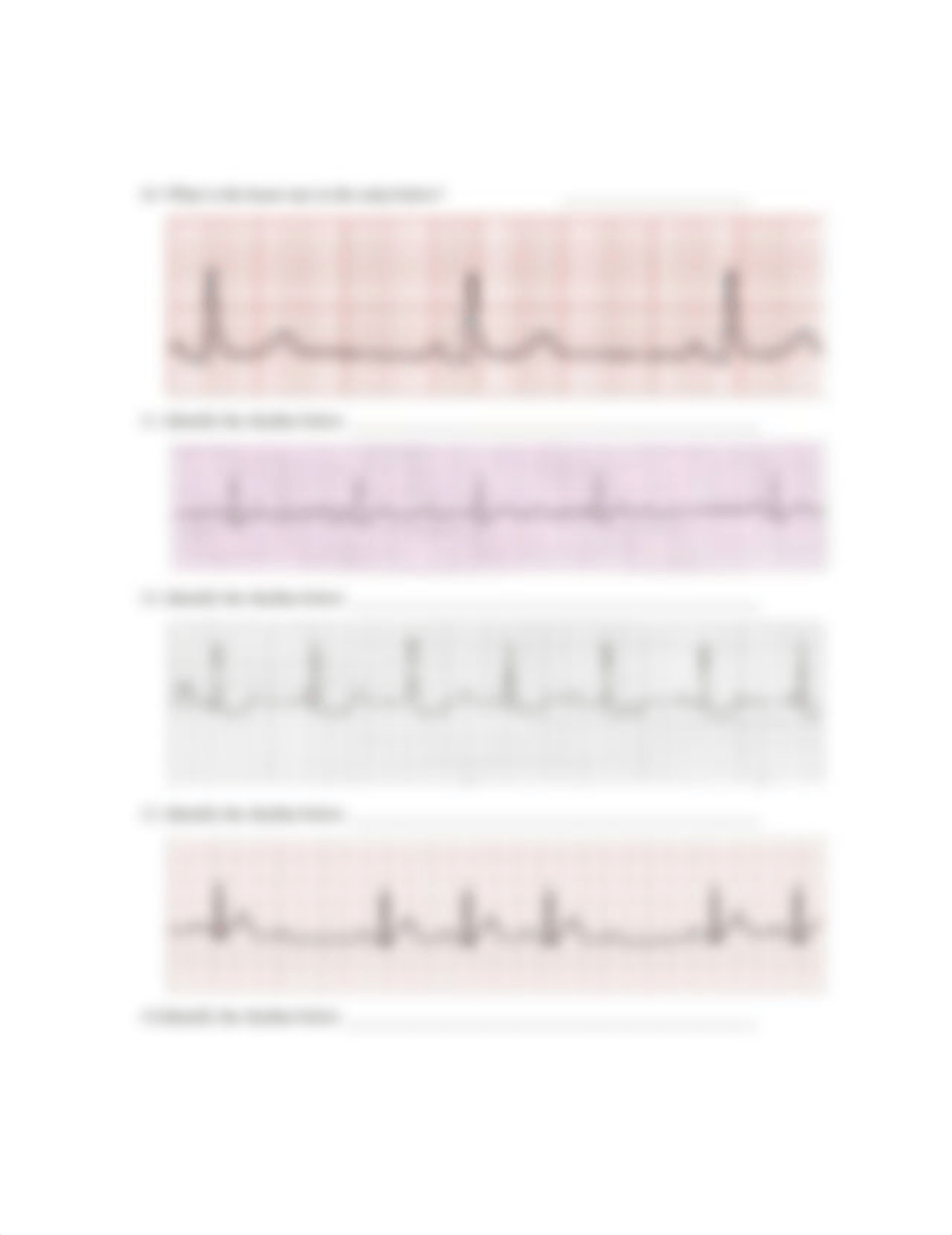 EKG Test - Fall 2019.docx_dlnv4a2z9in_page3