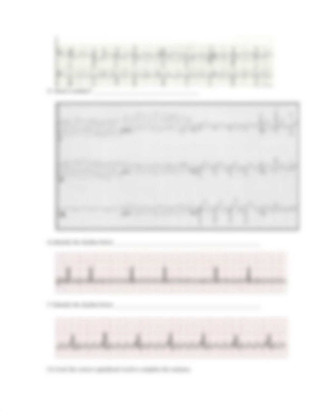 EKG Test - Fall 2019.docx_dlnv4a2z9in_page4