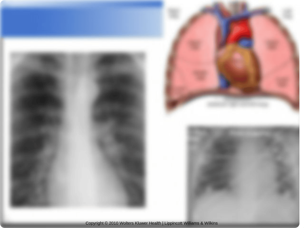 N200 week+5+activity+exercise+cardiac.ppt_dlqgqwzz7je_page3