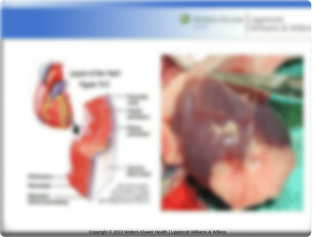 N200 week+5+activity+exercise+cardiac.ppt_dlqgqwzz7je_page4