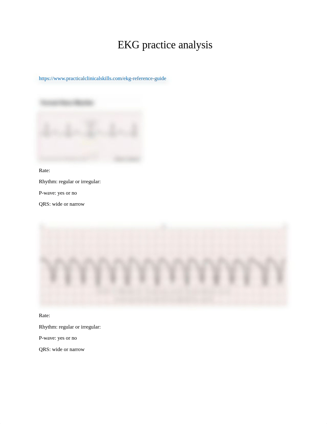 EKG practice analysis (1).docx_dlrxhfs6cq7_page1