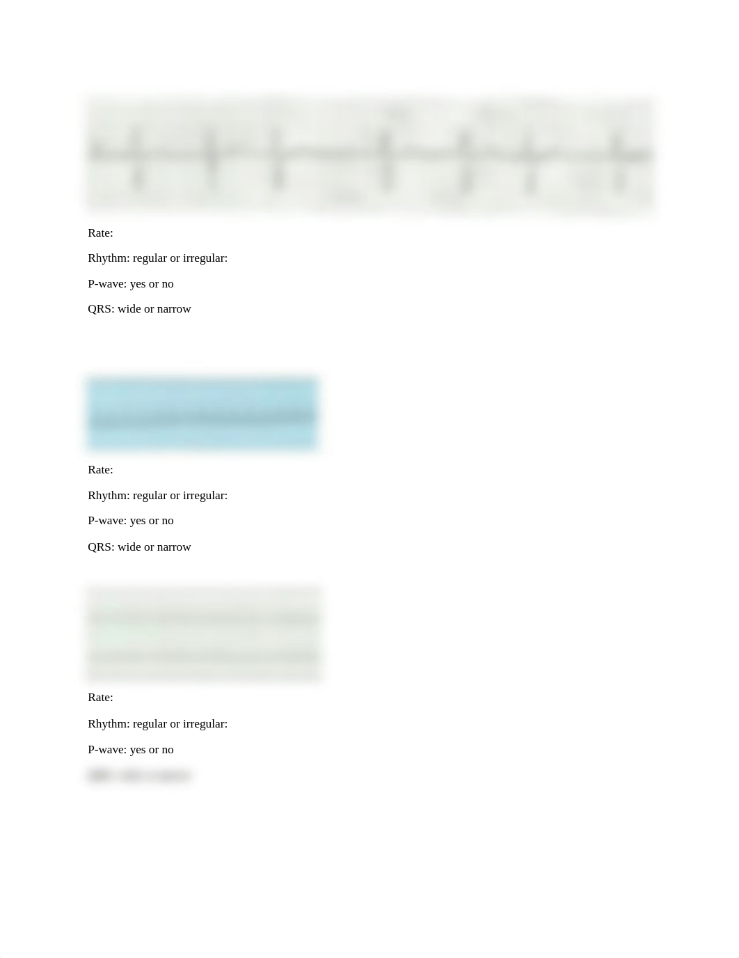 EKG practice analysis (1).docx_dlrxhfs6cq7_page2