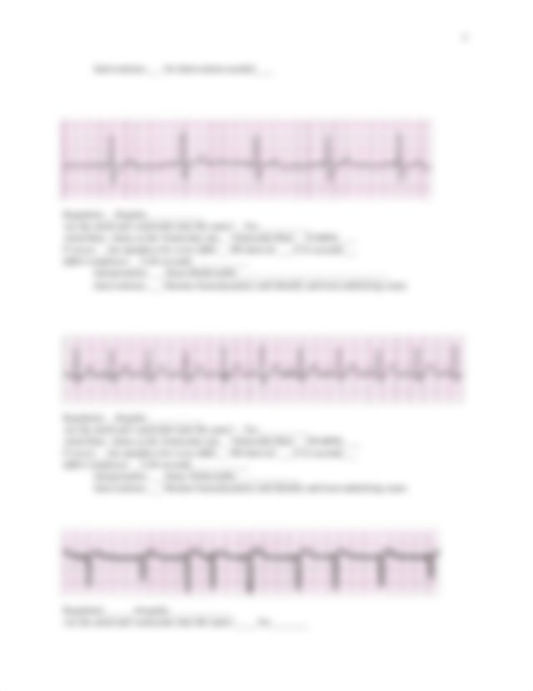 NURS 6035 EKG Interpretation practice strips.docx_dls7bhi72gq_page2