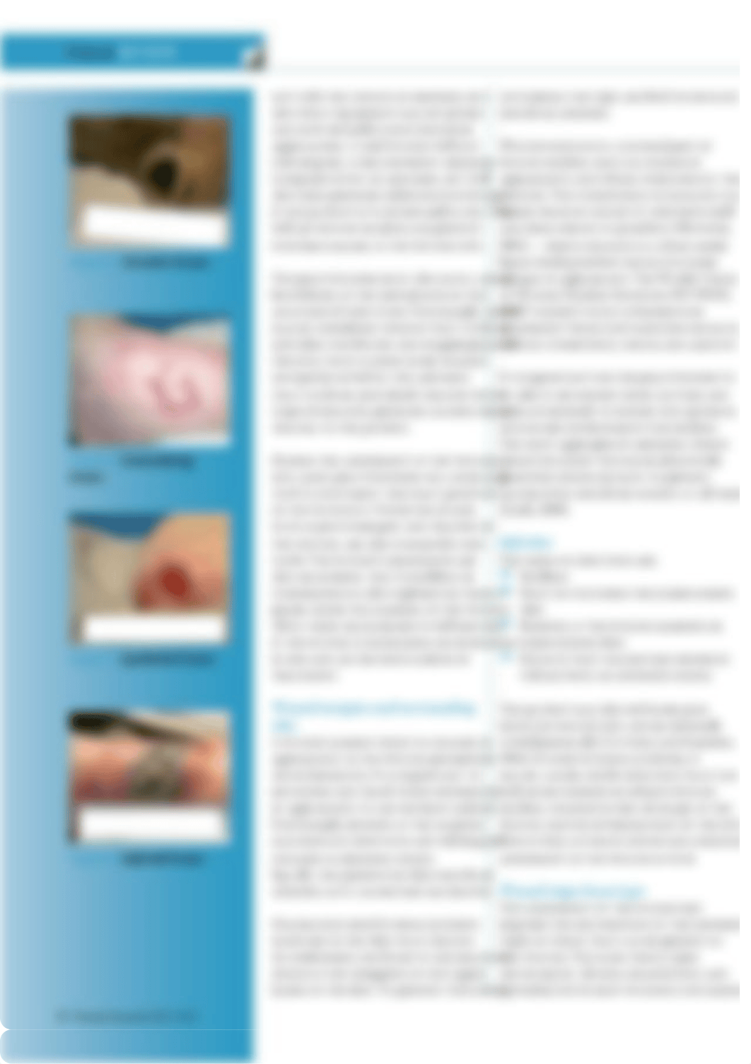 wound-essentials-72-understanding-the-basics-of-wound-assessment.pdf_dlwkjre9ii9_page3