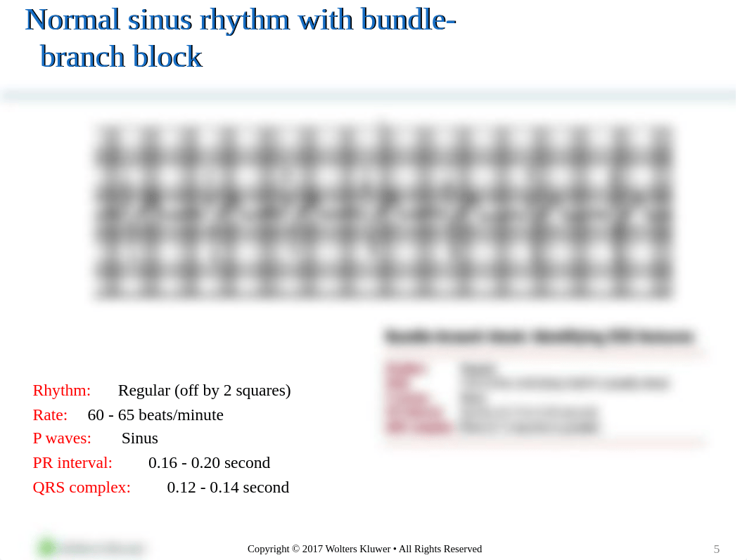 Ch 9 Ventricular Arrhythmias 1-20.pptx_dm3pzysasfc_page5