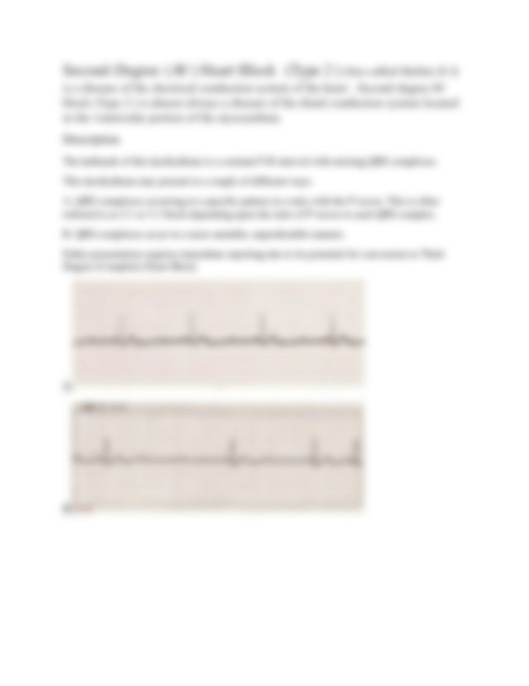 Heart Blocks.docx_dm6ekvjdrt5_page3