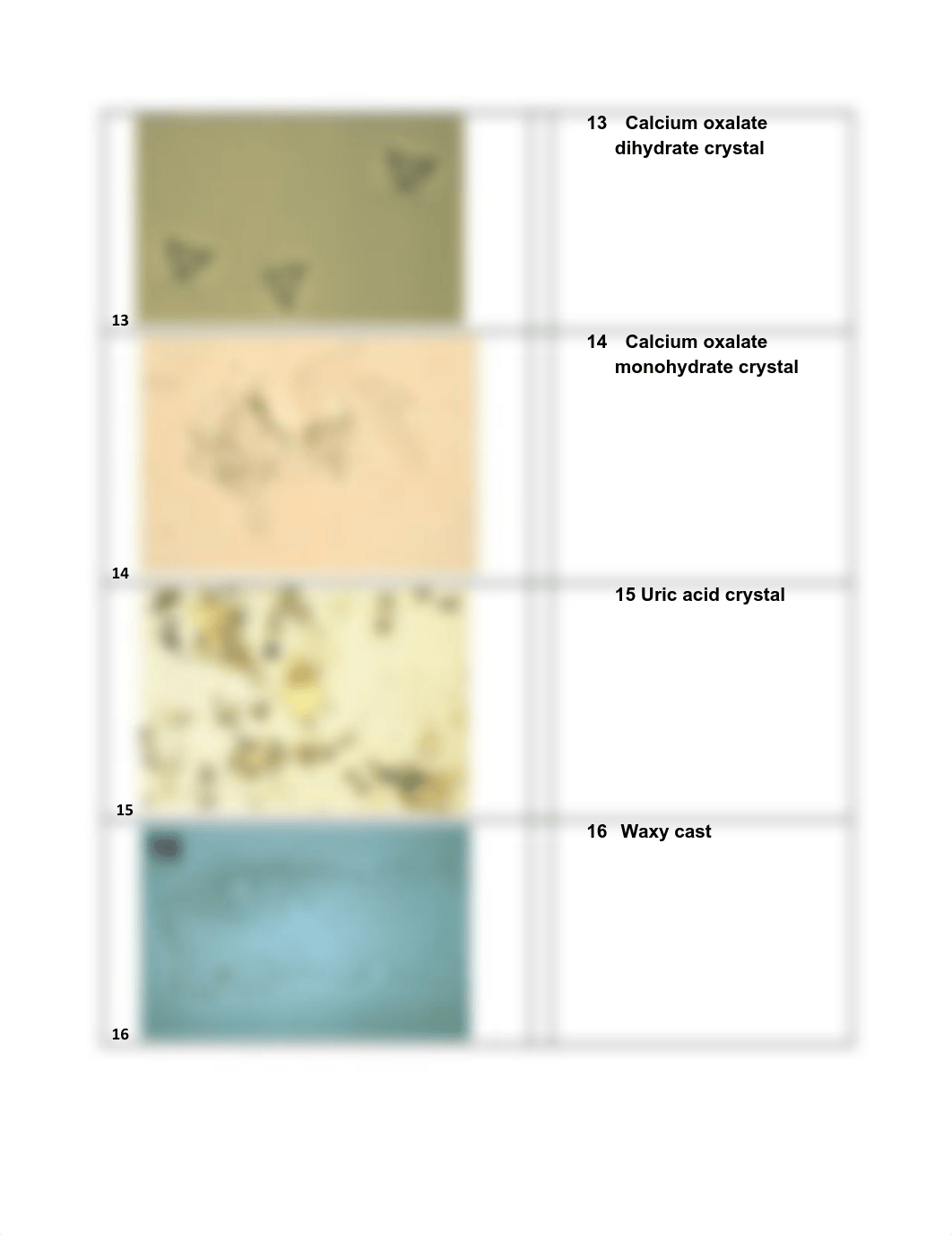 Assignment 11.2 Urine Sediment Review (1).pdf_dm6l4idz4tj_page5