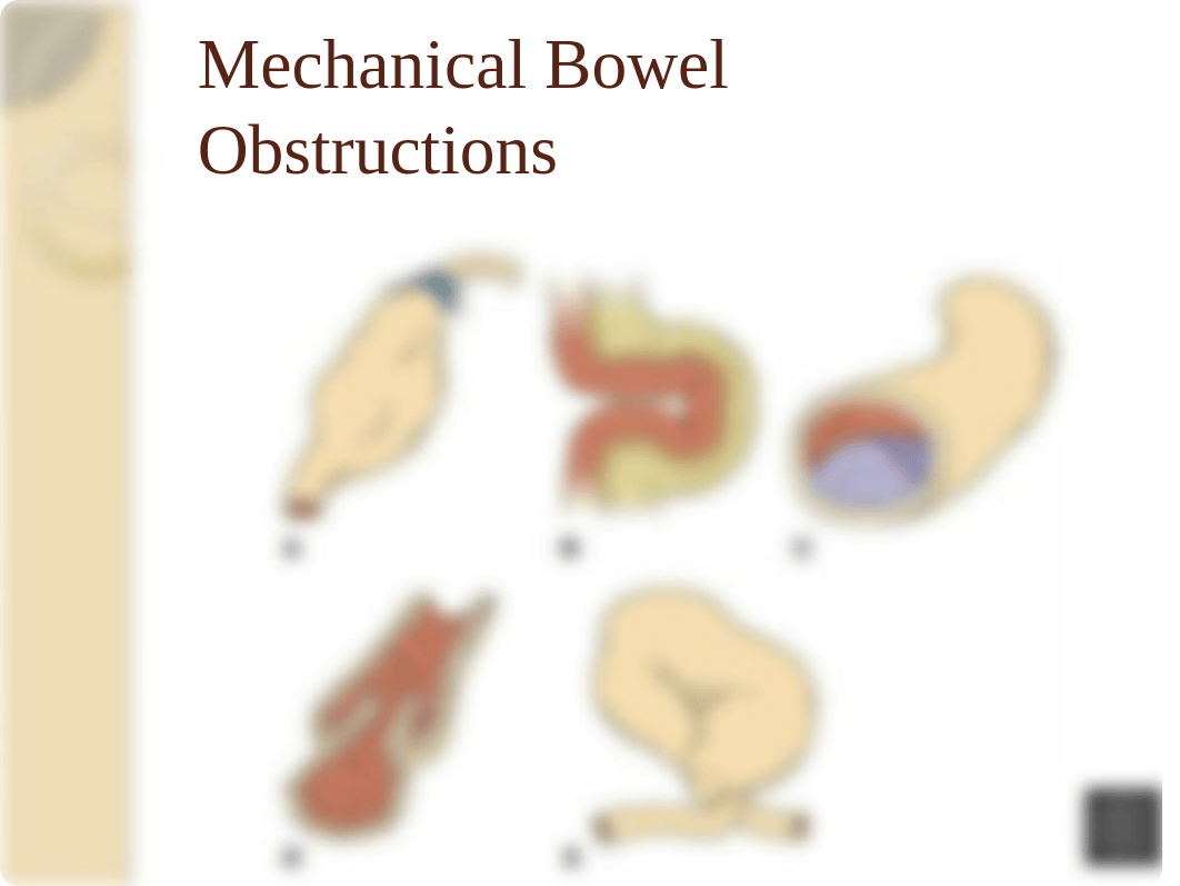 NGTubes and tube feeding audio'17_dmdsjg72sae_page5