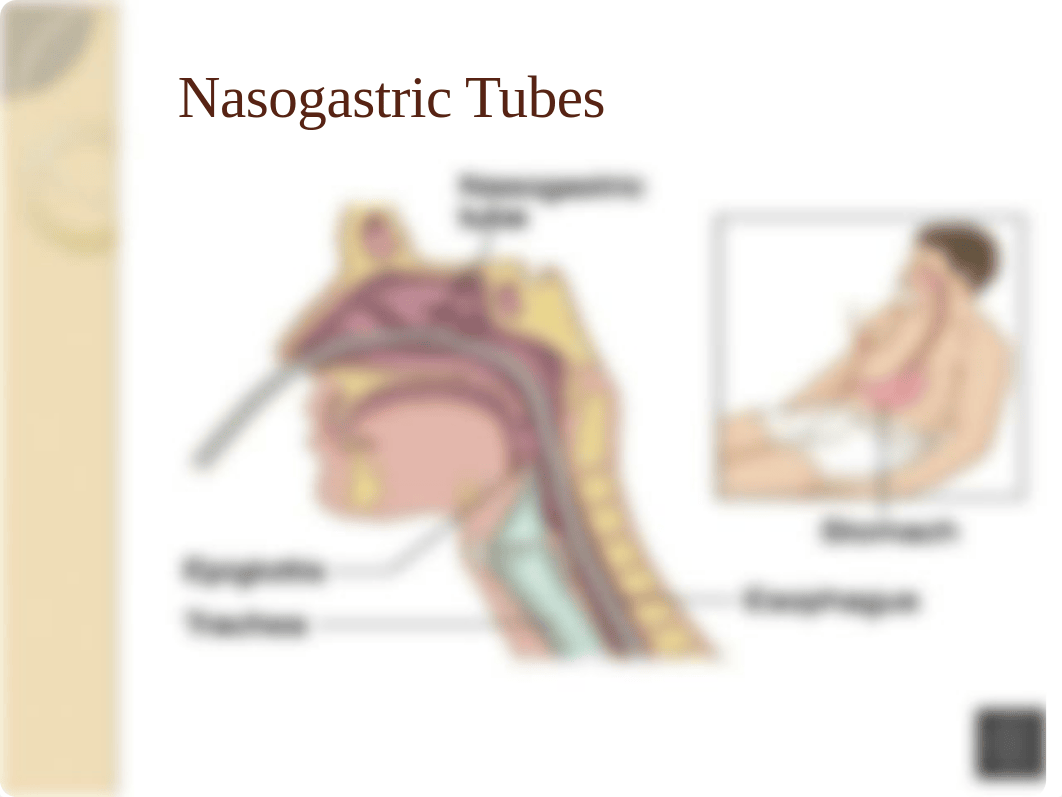 NGTubes and tube feeding audio'17_dmdsjg72sae_page2