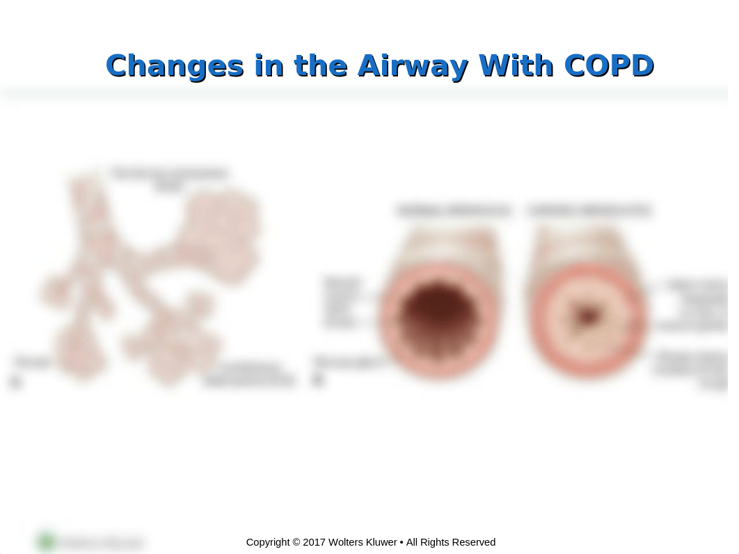 Lower Respiratory Chapter_55 (1).ppt_dmjn5ketafd_page2