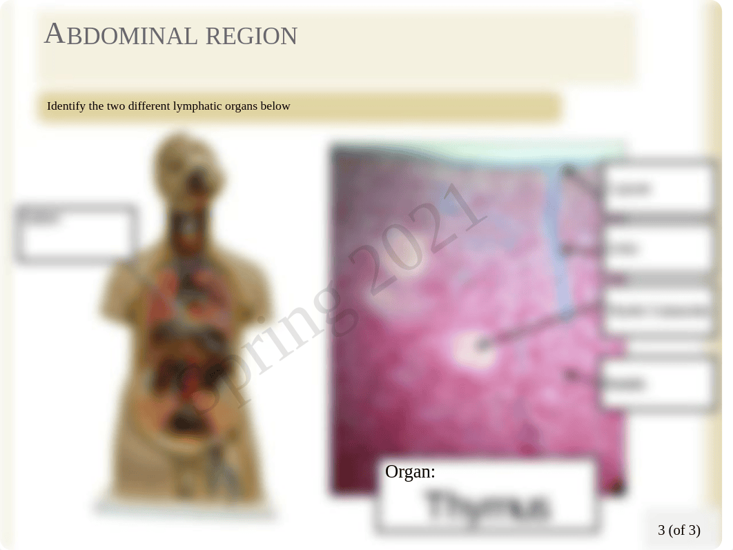 Bio 202 Ch20 Lymphatic Lab.pdf_dmk1hdjtpbq_page3