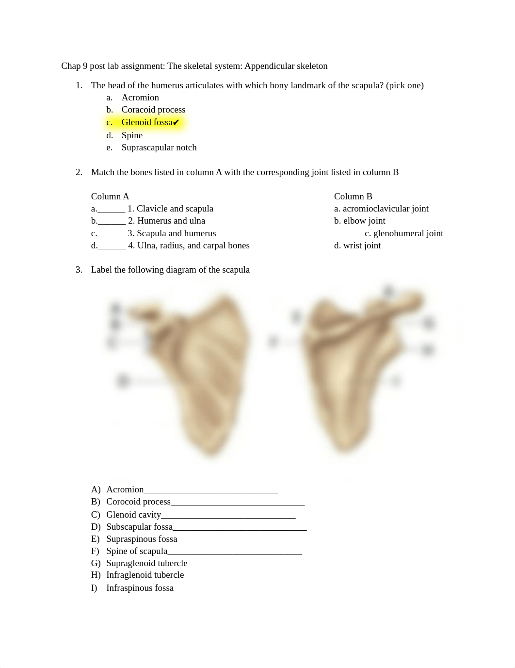 Chapter 9 post lab assignment Appendicular skeleton copy copy copy.docx_dmvj1gcz5jq_page1