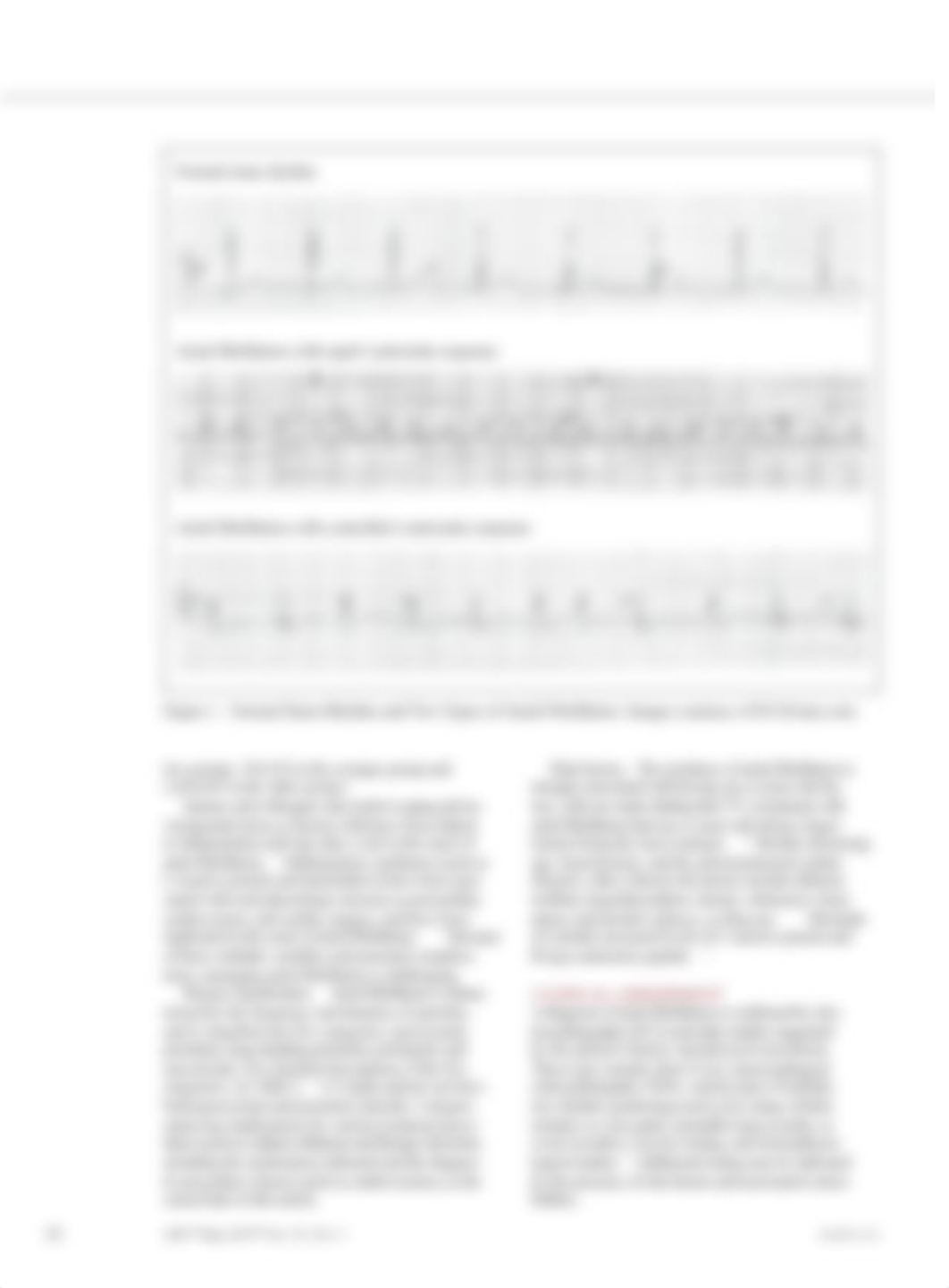 Atrial Fibrillation.pdf_dmzl2glwvcu_page3