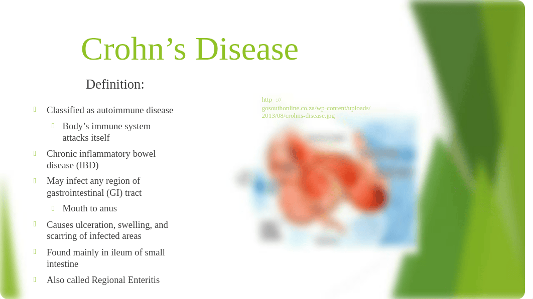 Crohns Disease PowerPoint_dn0is0zerq2_page3