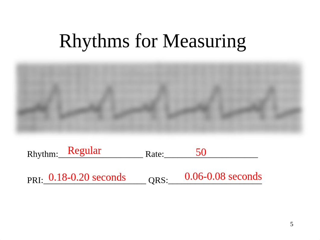 EKG Instructor Practice Strips.ppt_dn5o4ex6et2_page5