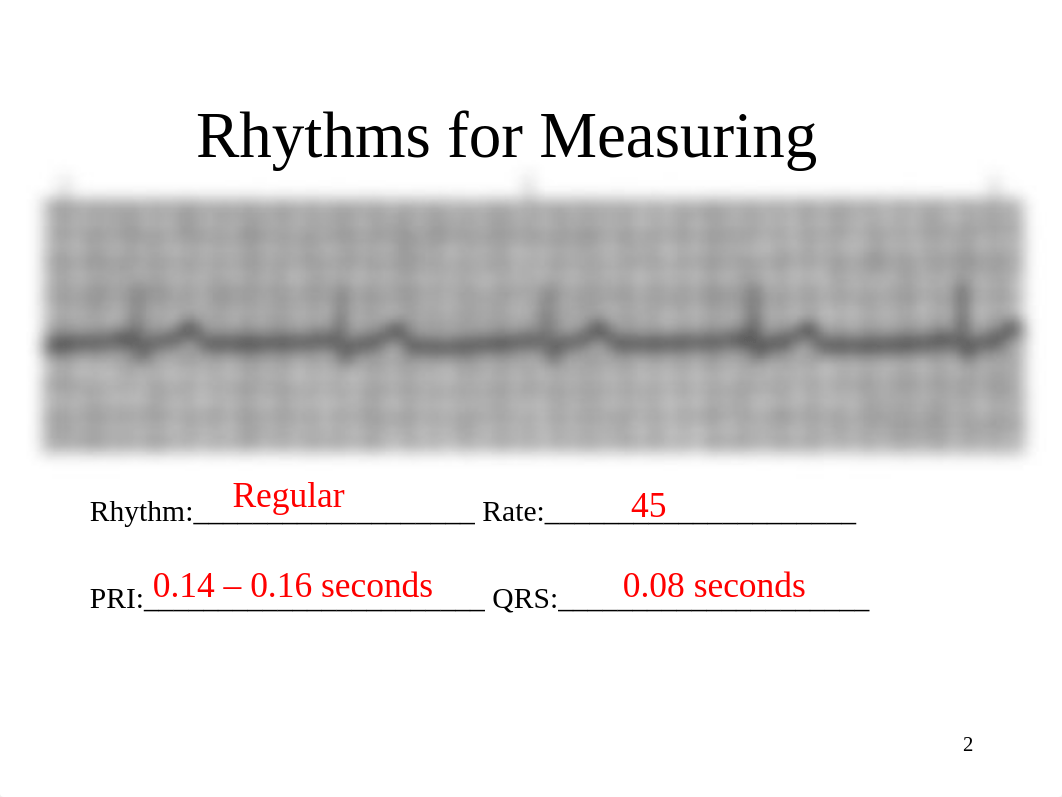 EKG Instructor Practice Strips.ppt_dn5o4ex6et2_page2