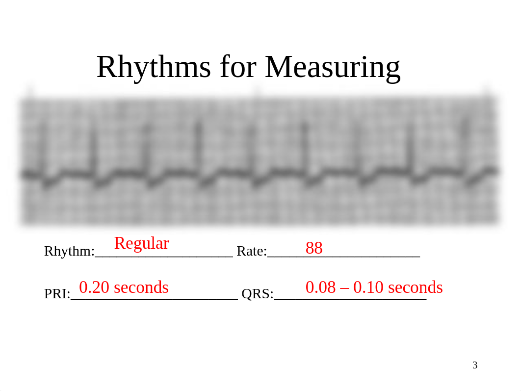 EKG Instructor Practice Strips.ppt_dn5o4ex6et2_page3