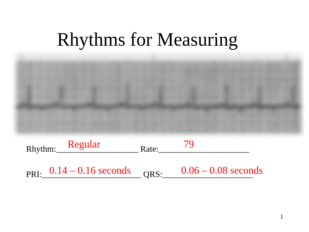 EKG Instructor Practice Strips.ppt_dn5o4ex6et2_page1