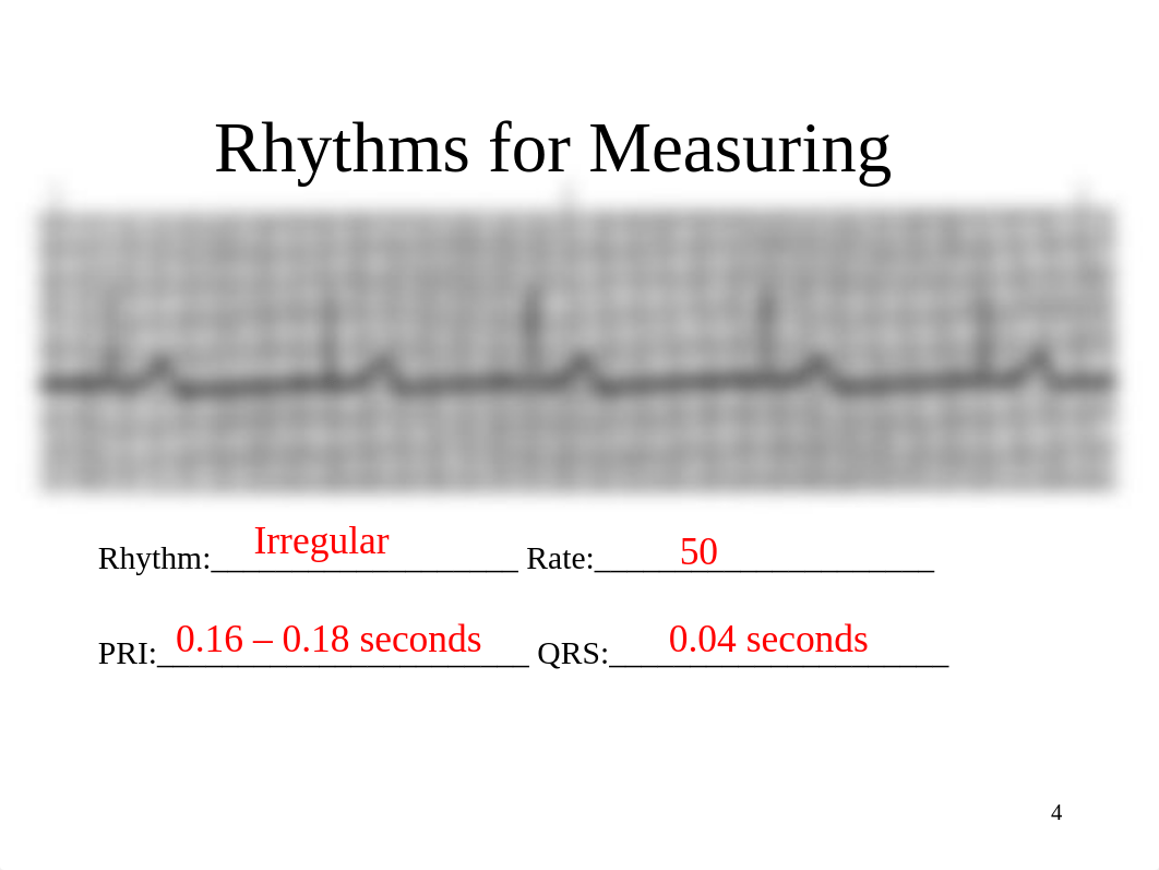 EKG Instructor Practice Strips.ppt_dn5o4ex6et2_page4