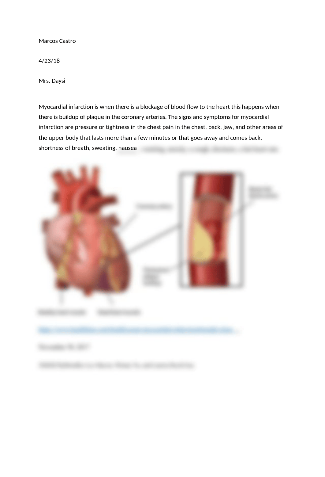 Myocardial infarction.docx_dn5xvq1gzki_page1