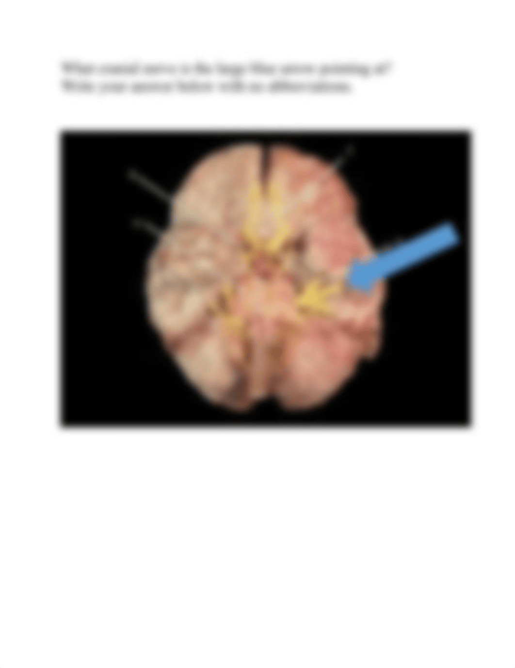 Practice Questions for Exam 1 AAO(2).docx_dn6mdxgndt4_page5