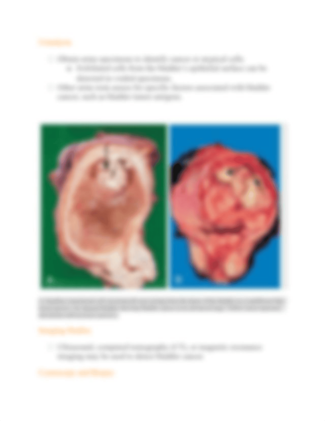 Bladder Cancer.docx_dn7ow2bjrpo_page3