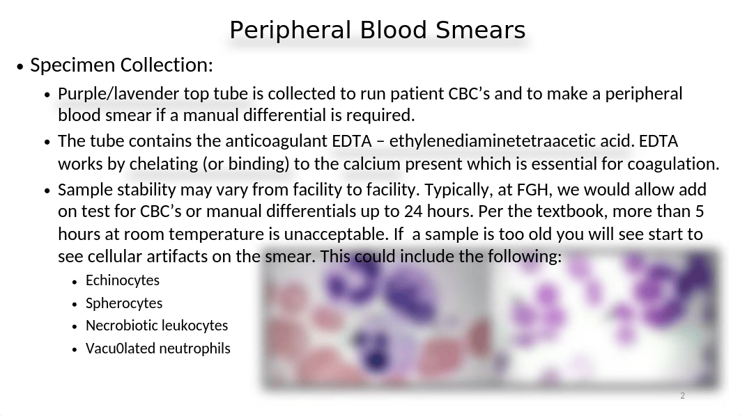 WEEK 1 - Wednesday Lecture - Examination of the Peripheral Blood Film and Correlation Chapter 13.ppt_dn8cwh4lzyb_page2