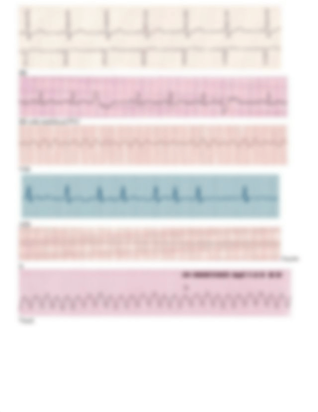 Dysrhythmia Practice Strips with Answers.docx_dna0ll7smg6_page2