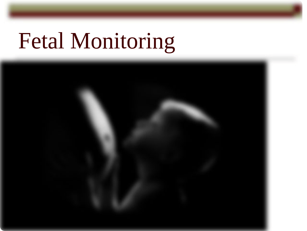 Fetal_Monitoring.ppt_dncuwqf66sk_page1