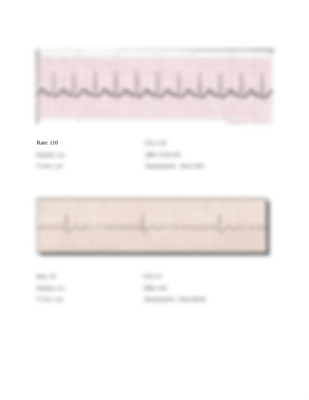 Week 11 Student EKG tracing worksheet.docx_dnd3q19icjj_page2