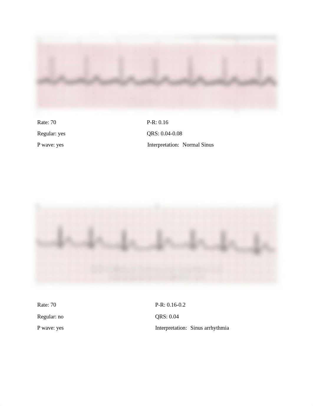 Week 11 Student EKG tracing worksheet.docx_dnd3q19icjj_page1