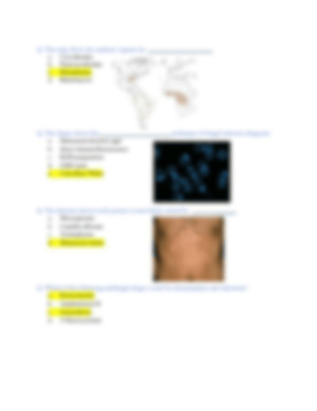 Medical Mycology Practice Questions with Answers.pdf_dndjv2jl7yb_page4