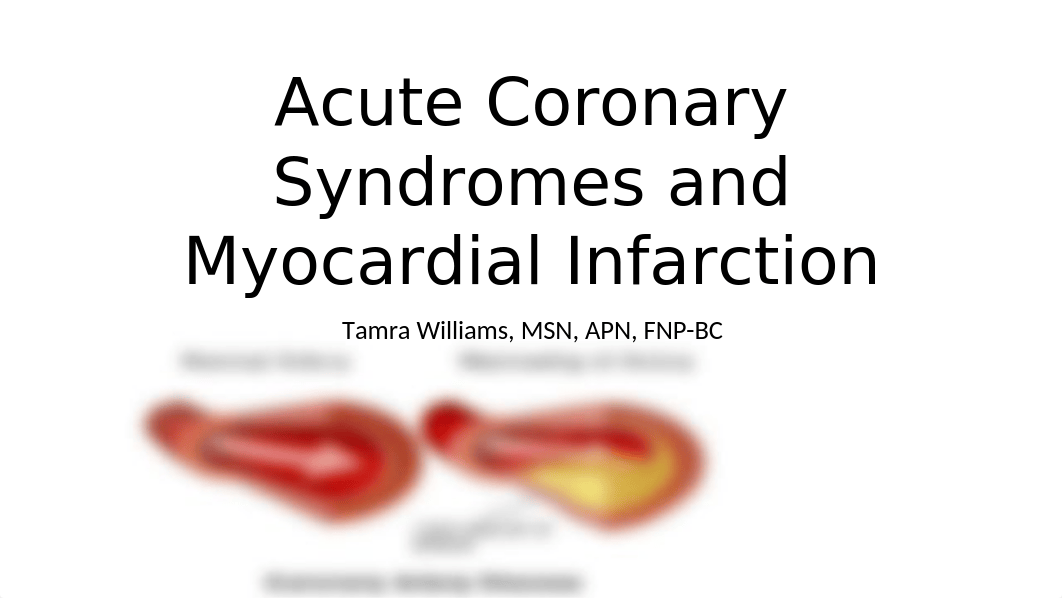 Acute Coronary Syndromes.pptx_dnjl7qu612l_page1