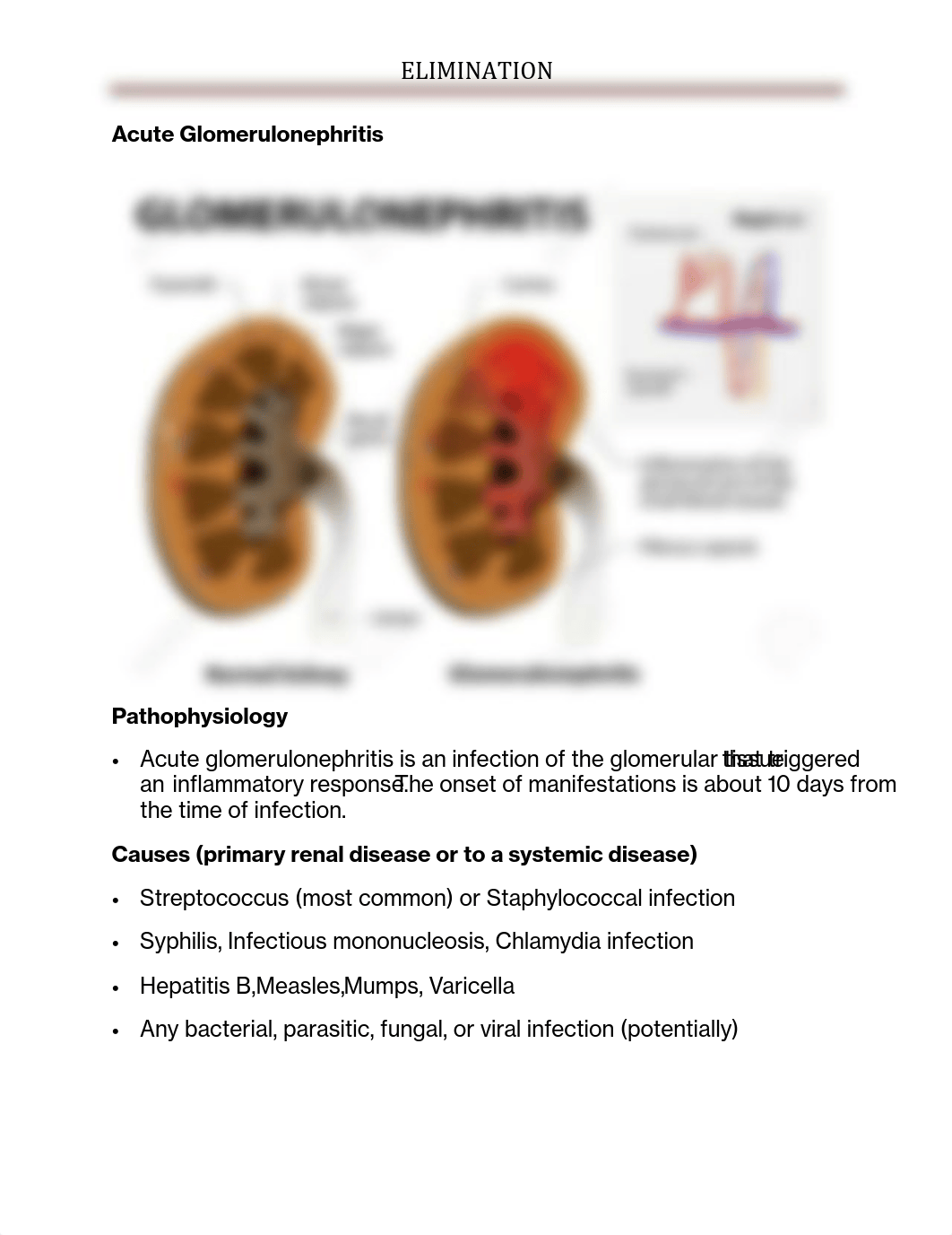 ELIMINATION
Acute Glomerulonephritis
Pathophysiology
 Acute glomerulon_dnm1iaga490_page1