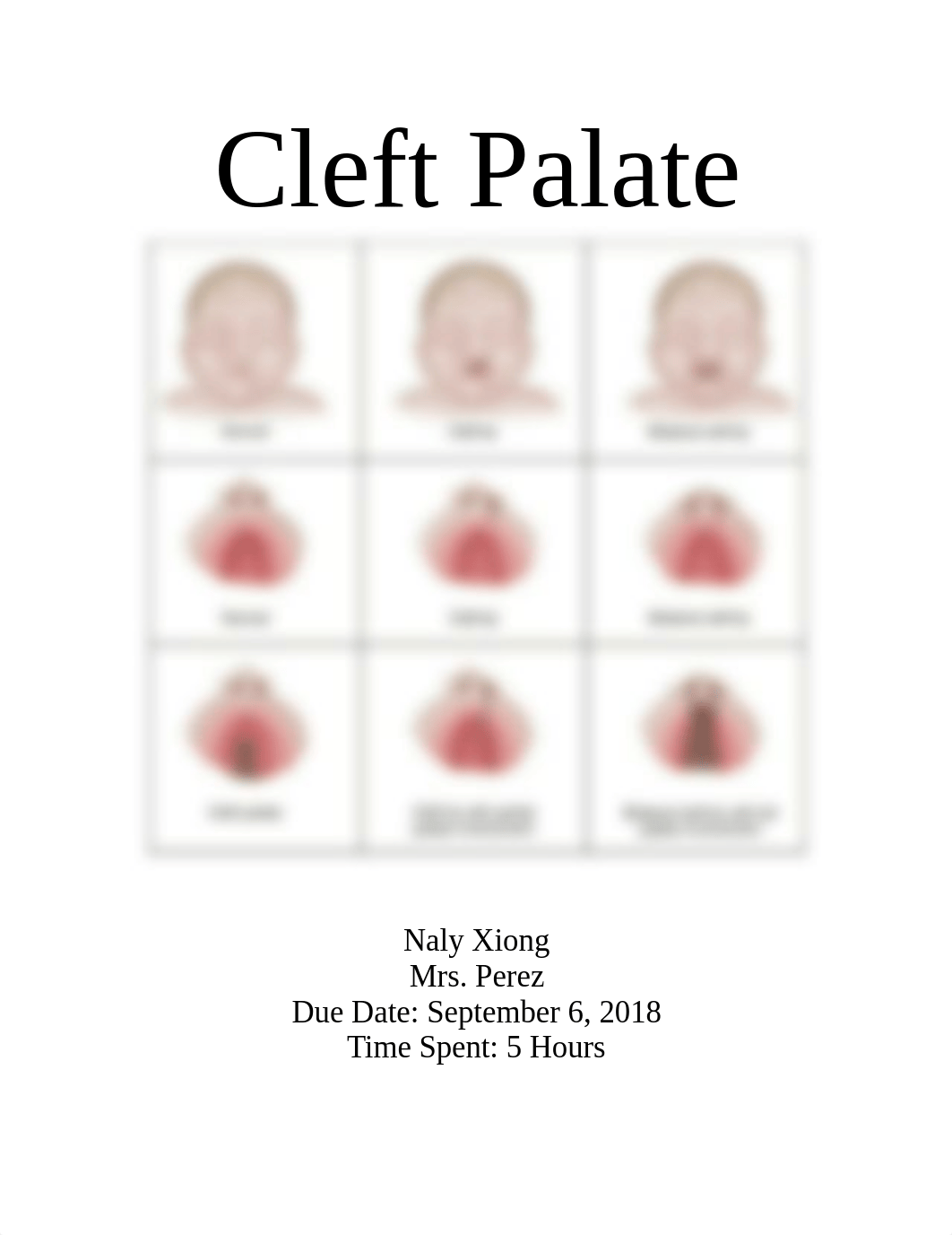 cleft palate.doc_dnspdpcjtwj_page1