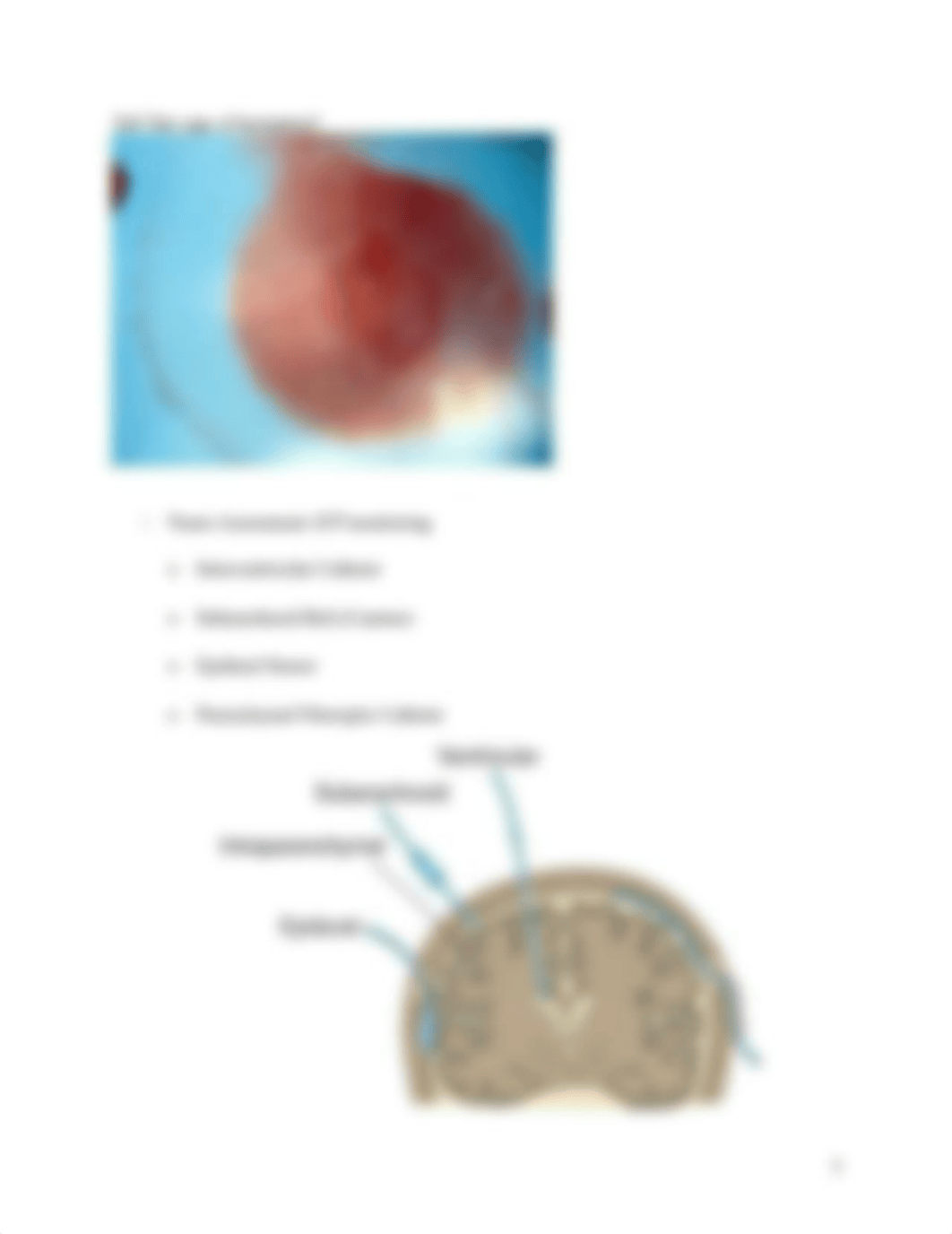 Increased intracranial pressure Traumatic Brain Injury Stroke.docx_dnwniox43l3_page5