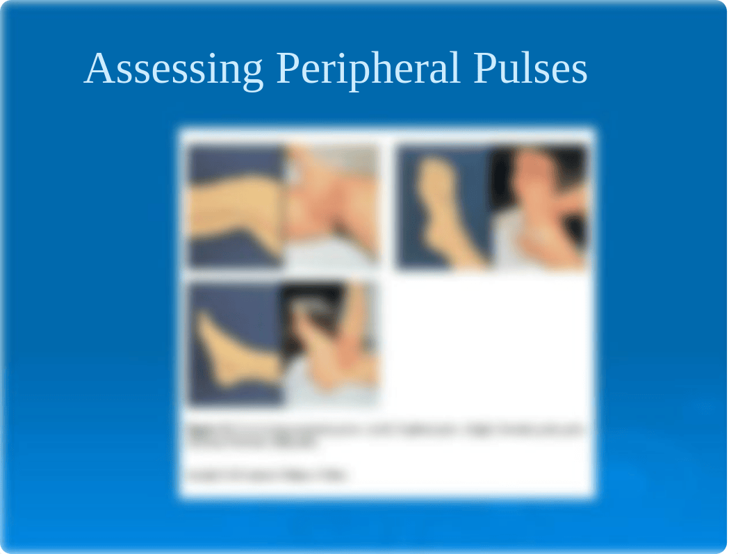 Chap 30 Peripheral Vascular Disorders.2014 hhm(3)-1-2_dnxb96gt5jp_page5